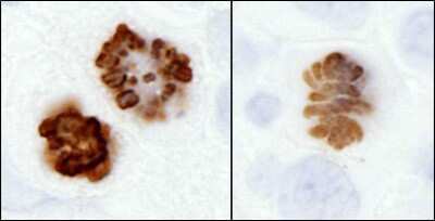 Immunohistochemistry-Paraffin: HIST1H3A [p Ser10] Antibody [NB100-97852]